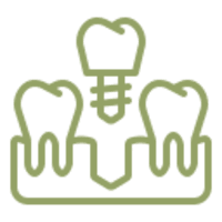 dental implants