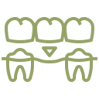 partial crowns (onlays & inlays)