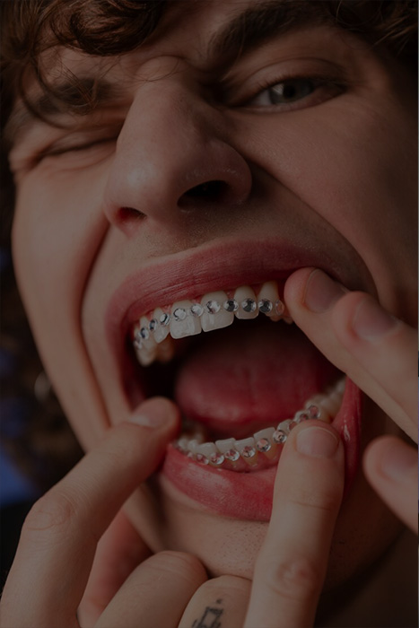 orthodontics in glendale