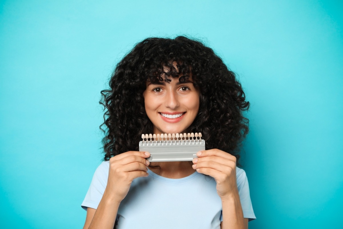 veneers before a special event